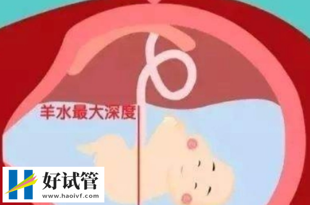 羊水量的變化可以判斷胎兒發育情況