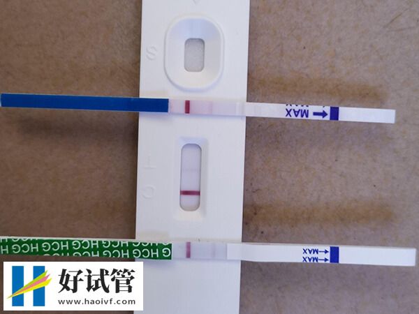 移植兩個胚胎需要什么條件