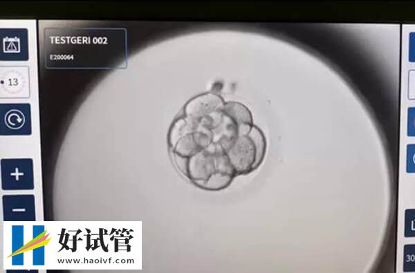 陰超下進行胚胎移植能找準位置