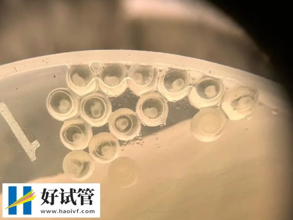 株洲婦幼沒(méi)有現(xiàn)卵