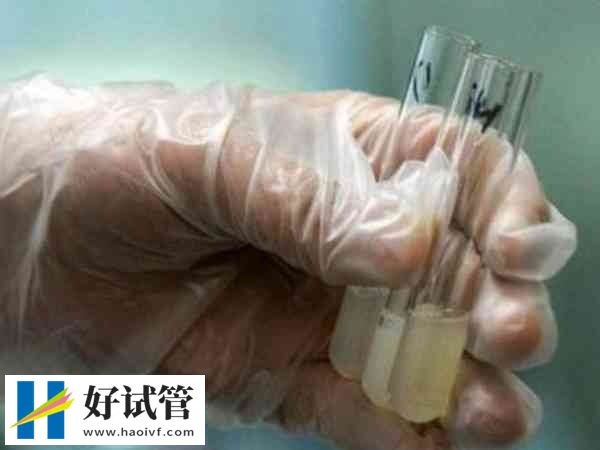 白細(xì)胞精子癥會(huì)影響精子功能