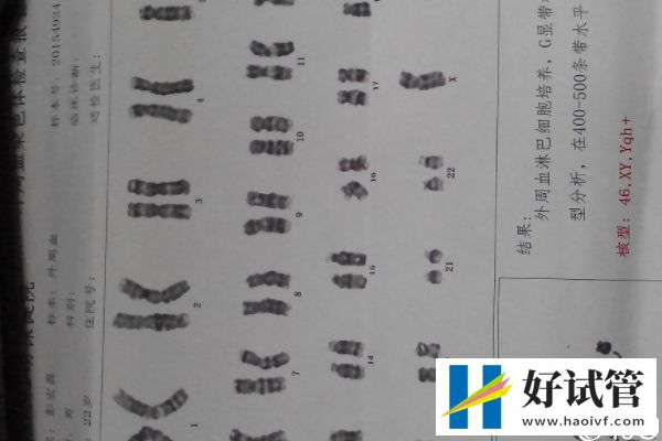 染色體異常胚胎質(zhì)量差