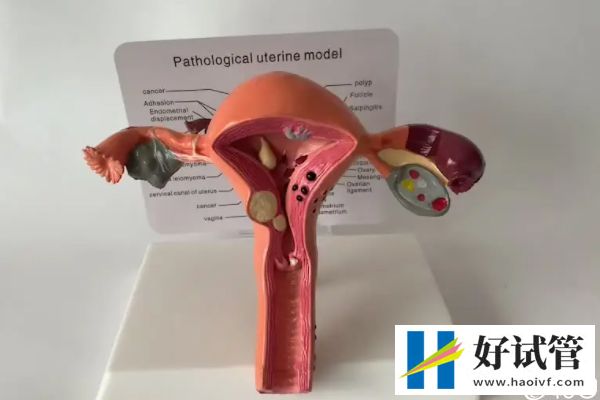 試管取卵有風險