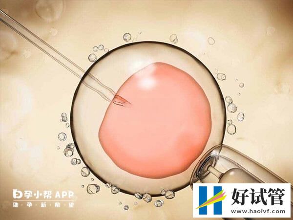 盛京醫院供精試管收費在3-8萬元不等