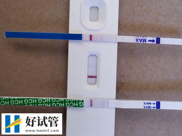 郴州市第一人民醫院生殖科如何