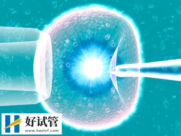 承德地區(qū)做試管嬰兒選楊波醫(yī)生好