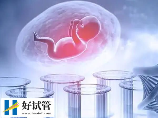 揚州做試管嬰兒選董乃俊醫生好