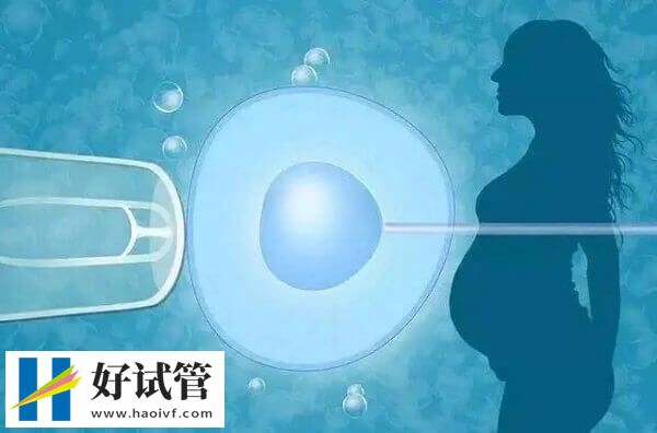 年齡是影響試管成功率的因素之一