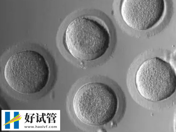 攢夠4-5個(gè)胚胎才能進(jìn)行移植