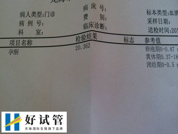 孕酮指標只是相對而不是絕對的參考值