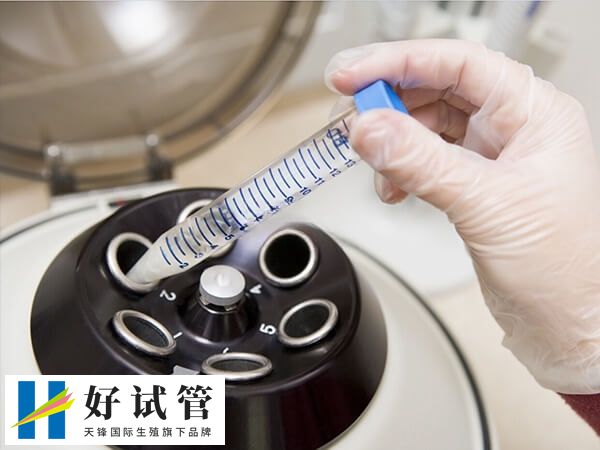 胚胎移植過程大約5-15分鐘左右