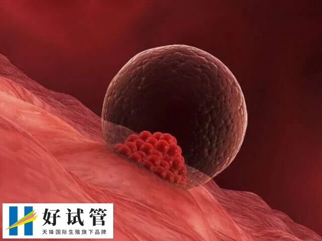 卵泡發育成熟之后就可以安排取卵