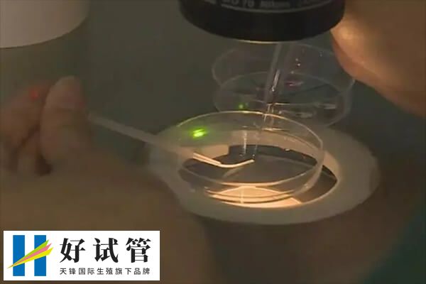 試管促排是一種常見的輔助生殖技術(shù)