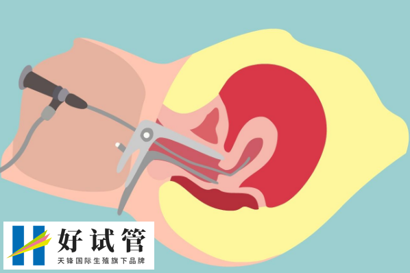 上海市不孕不育醫(yī)院做試管嬰兒一般得多錢?哪家醫(yī)院成功率最高?(圖1)
