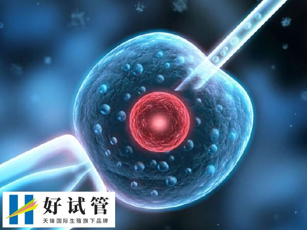 取卵手術是一個相對簡單的過程