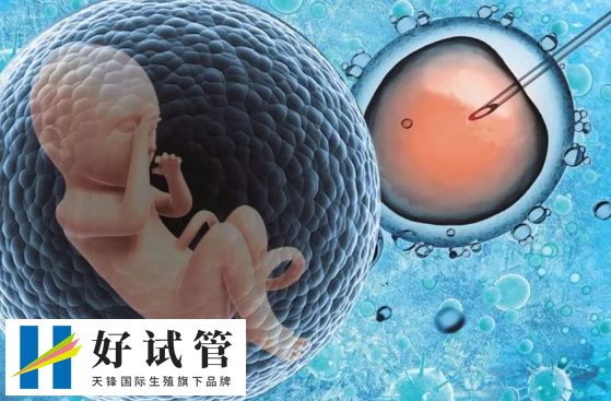 試管嬰兒