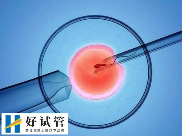 試管嬰兒手術前需要取卵